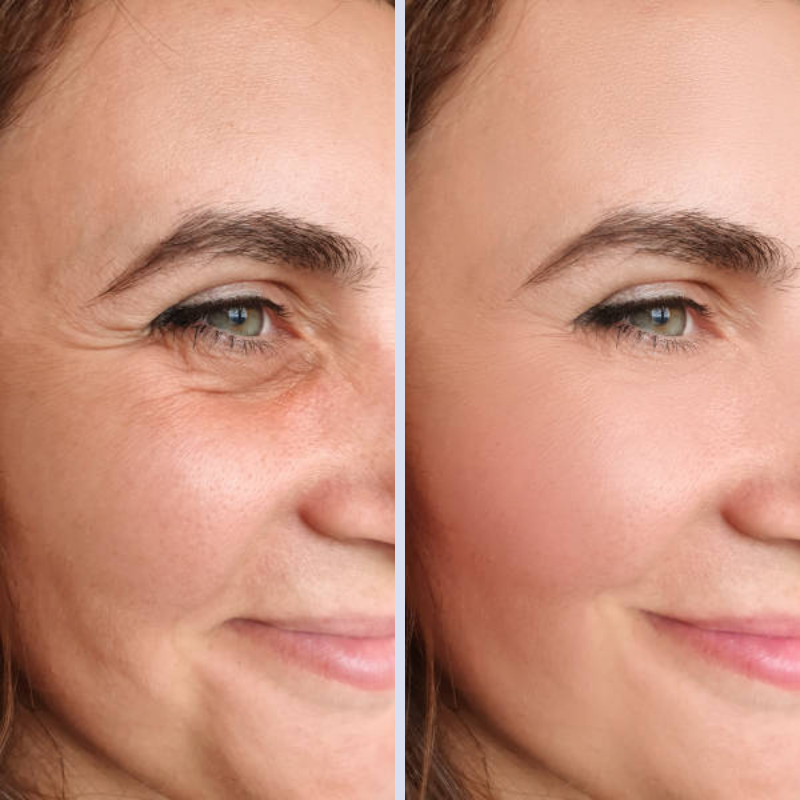 NOVO FaceLift™ 2.0 Redutor de Gordura Facial  4 em 1 + Ebook Exclusivo de Brinde com 57 RECEITAS PARA EMAGRECER 30kg em 30 Dias