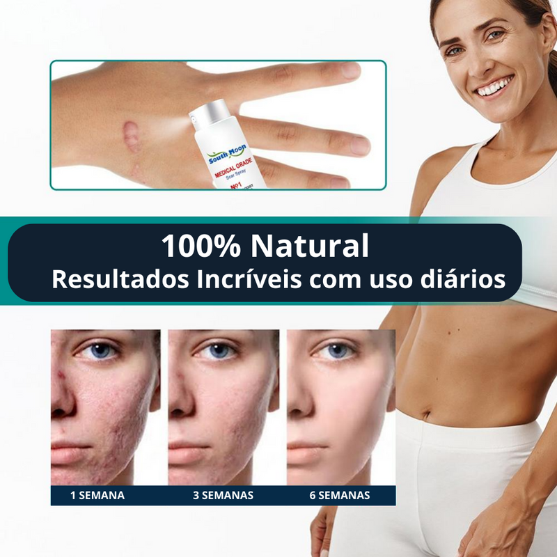 Scar Remove™ Removedor de Cicatrizes, Estrias e Marcas na Pele - Tenha um Corpo Lindo Novamente