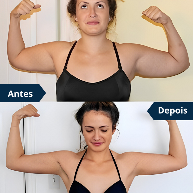 FitArm™ Cinta Redutora de Gordura e Flacidez - Tenha Braços Firmes e Saudáveis novamente + LEVE 2 e PAGUE 1