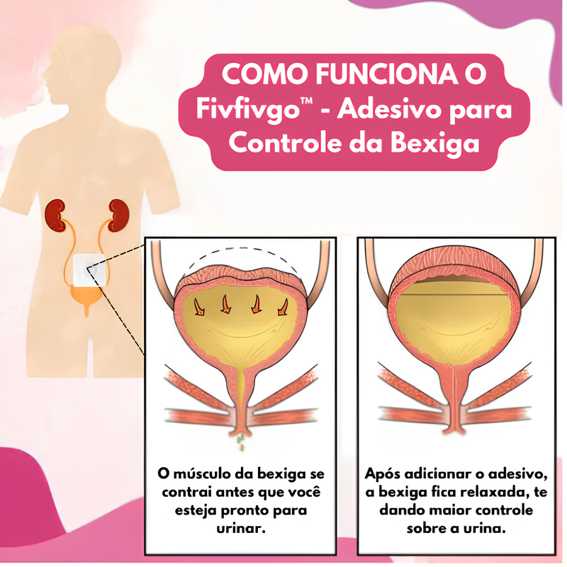 Fivfivgo™ - Adesivo para Controle da Bexiga e Anti-Incontinência Urinária